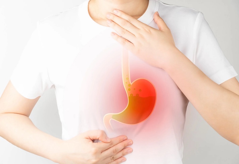 Trào ngược dạ dày thực quản (GERD)